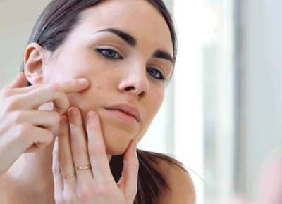 5 Ways to Fade and Prevent Acne Scars